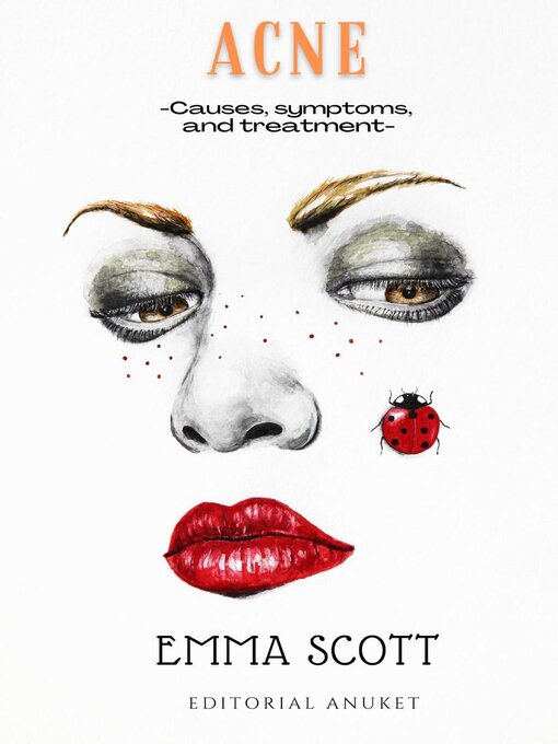 Title details for Acne by Emma Scott - Available